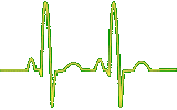 EKG